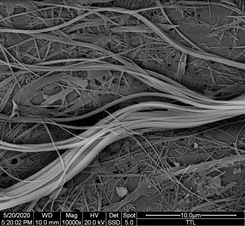 Electron microscope image showing light-coloured oblong asbestos fibres and fibre bundles.