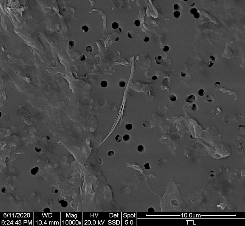 Electron microscope image of an individual asbestos fibre bundle. 